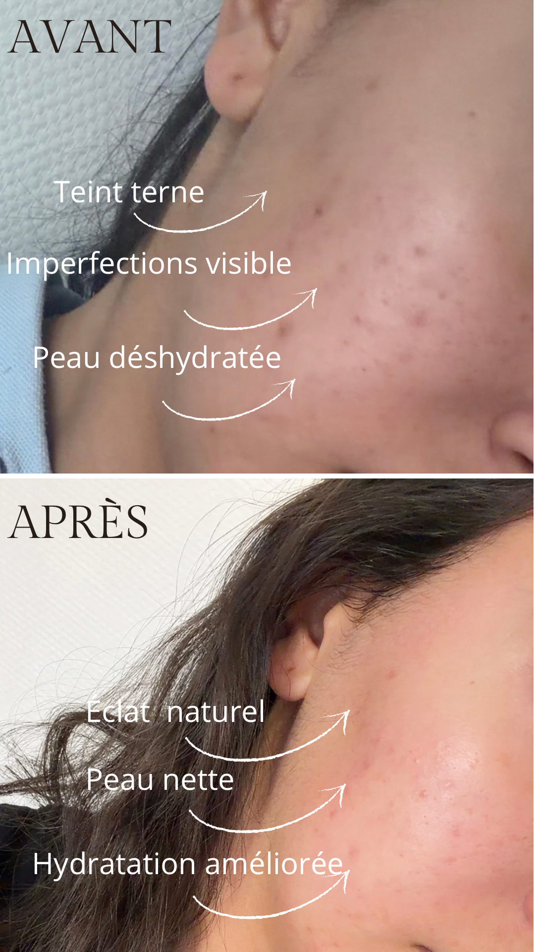 Routine Visage Complète – Savon, Sérum & Crème